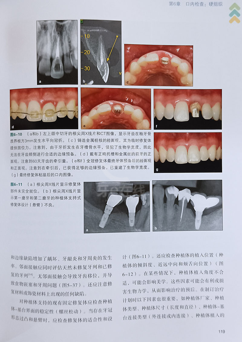 牙齒修復前沿技術觀點論述